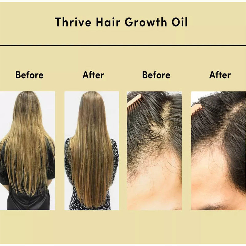 Thrive Hair Growth Oil -60 ml